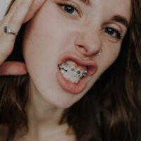 crop eccentric woman demonstrating teeth braces and touching face