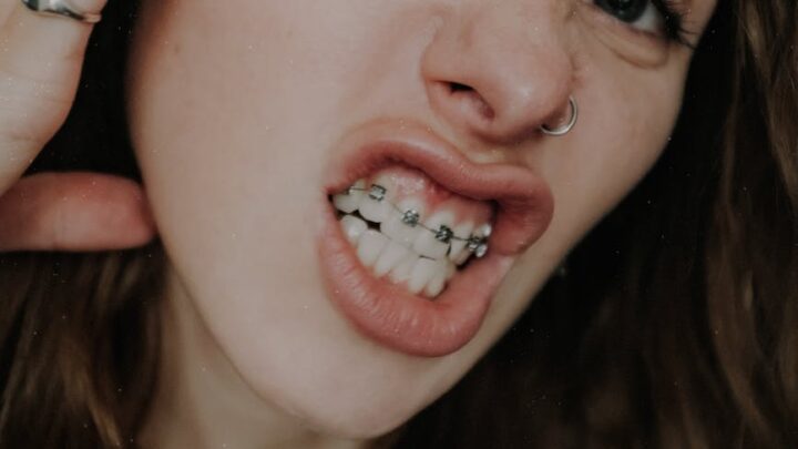 crop eccentric woman demonstrating teeth braces and touching face